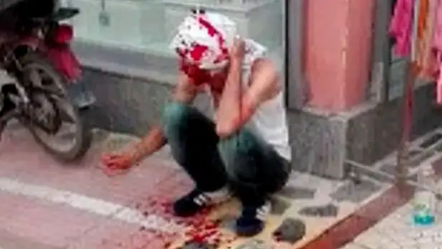 Konya'da kardeş davulcuların kavgası kanlı bitti
