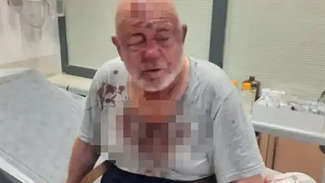 Konya'da kira nedeniyle 84 yaşındaki kişiyi darbettiği öne sürülen 2 zanlı gözaltına alındı
