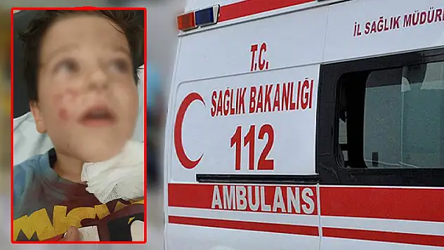 Konya'da köpeğin saldırdığı çocuk yaralandı
