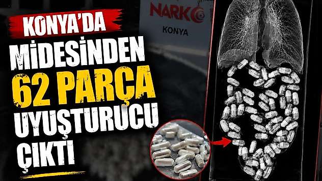 Konya'da midesinden 62 parça uyuşturucu çıktı