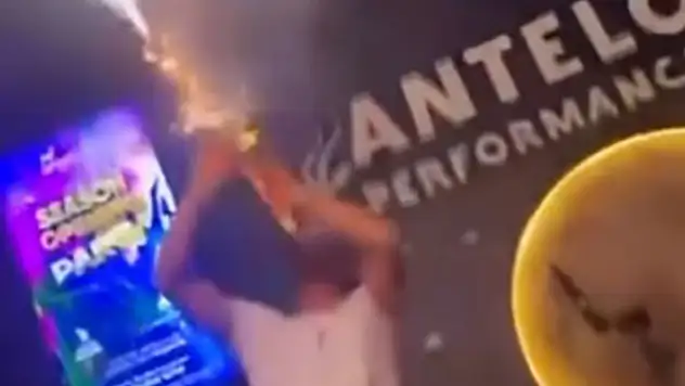 Konya'da müzisyen, şov için klarnetine taktığı konfeti ile kendini yaktı
