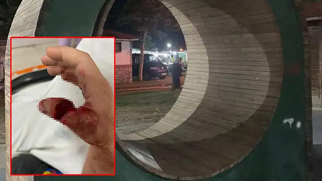 Konya'da parkta oynayan çocuğun çarka sıkışan parmağı kopma noktasına geldi
