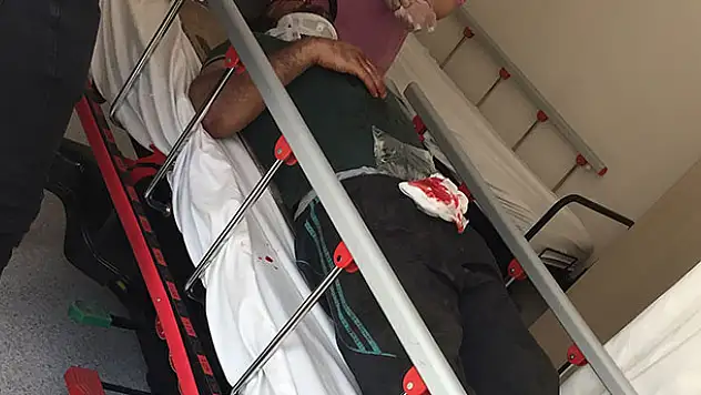Konya'da patlayan lastik tamirciyi hastanelik etti