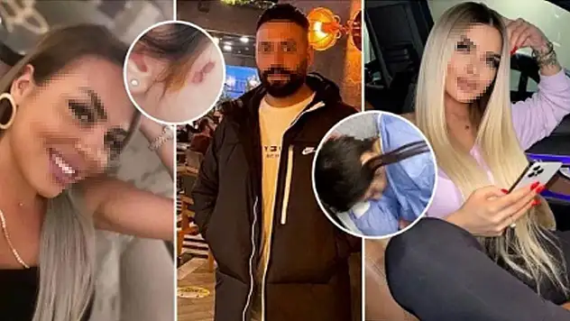 Konya'da rezidansta 3 kişi tarafından darbedilen genç kadının Adli Tıp Kurumu raporu çıktı
