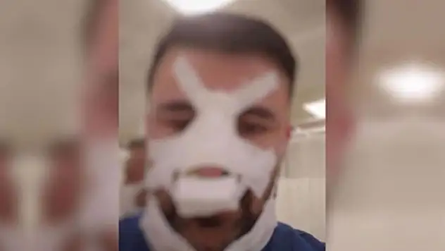 Konya'da sağlık çalışanının burnunu kıran şüpheli tutuklandı