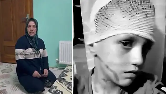 Konya Valiliği, üzerine kezzap atılarak yaralanan Yusuf ile ilgili açıklama yaptı