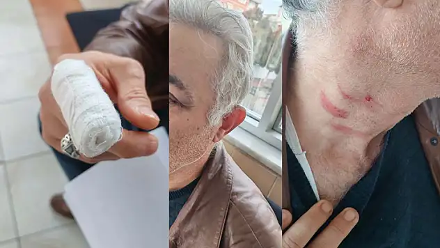 Konya'da akıl almaz olay! Müezzinden aile hekimine saldırı