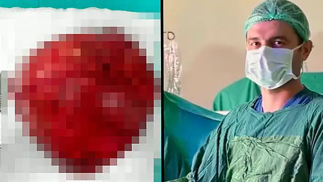 Konya'da bir hastanın karın boşluğundan 40 santimetre büyüklüğünde kitle çıkarıldı