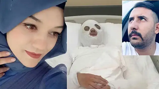 Konya'da eski nişanlısının yüzüne kimyasal madde atan sanığın cezası 16,5 yıla çıktı