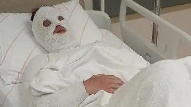 Konya'da kezzapla saldıran eski nişanlı için bu ceza istendi