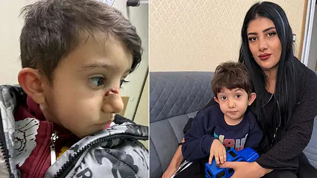 Konya'da oğlunun durumunu gören anne kreşten şikayetçi oldu: İhmal var
