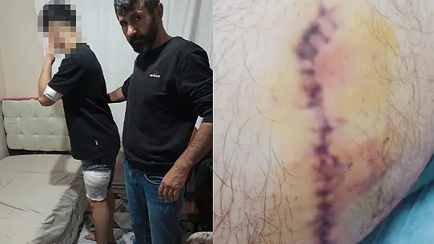 Konya'da okulda başlayan kavga okul dışına taştı, liseli çocuk bıçaklandı