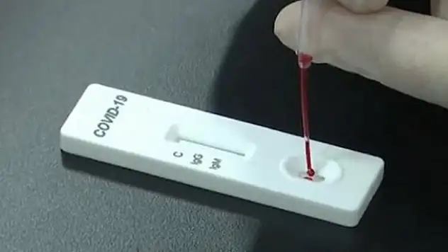 Korona testi için hızlı kit üretildi