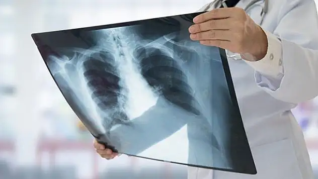 Koronada kontrolü kaybettik! Konya'da pnömoni oranı yüzde 8.78 oldu
