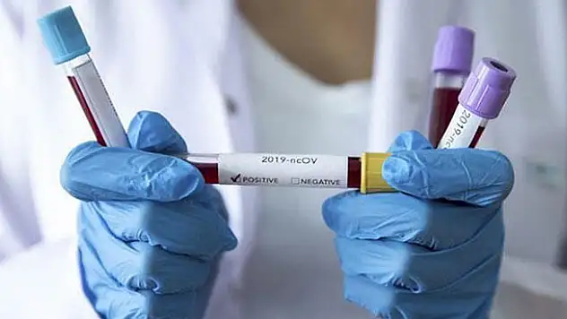 Koronavirüs tablosu 6 Eylül! Bugün Türkiye koronavirüs vaka ve vefat edenlerin sayısı kaç?