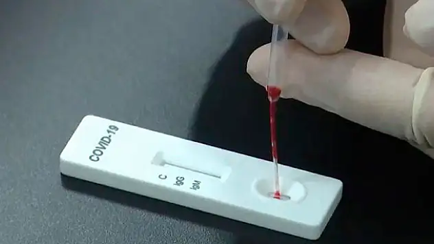 Kovid-19'da hata payını en aza indiren test kiti sağlık çalışanlarına uygulanıyor