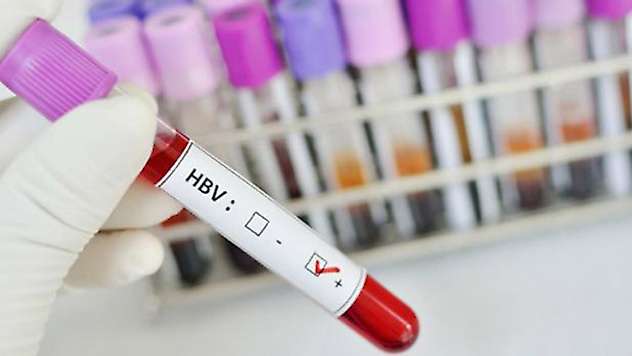 Kronik Hepatit B belirtileri nelerdir?