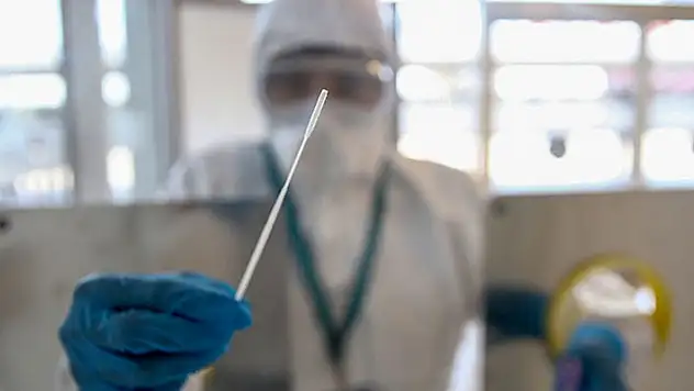 KTO Karatay Üniversitesi milyonlarca çalışanı ilgilendiren PCR testi sorularını yanıtladı