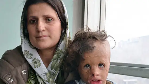 Küçük Demhat tedavi olmayı bekliyor