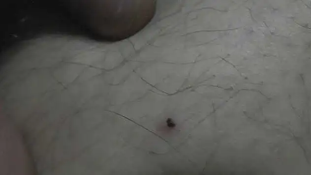 Kulu'da Kene Vakaları Çoğaldı