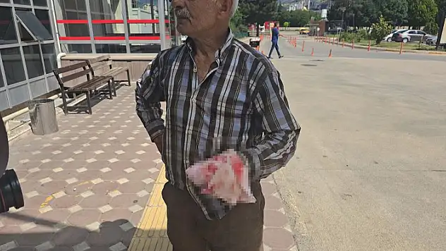 Kurban keseyim derken parmaklarını kesti
