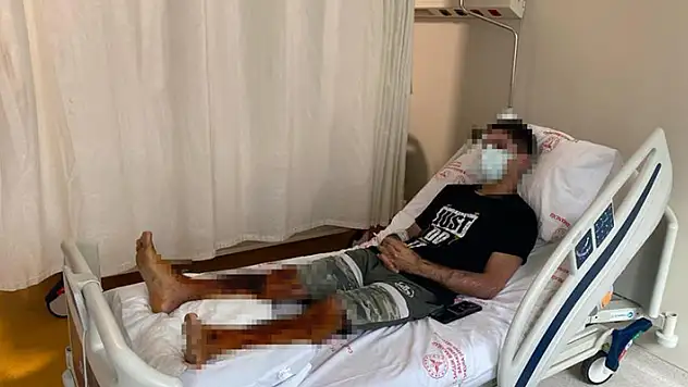 Lavabo açıcı bomba gibi patladı, 21 yaşındaki gencin vücudunun yüzde 35'i yandı