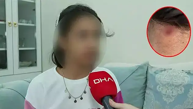 Maganda kurşunu 11 yaşındaki kızın boynuna isabet etti!