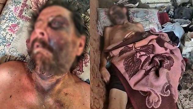 Metruk evde insanlık dramı! Çöpler arasında can çekişiyordu