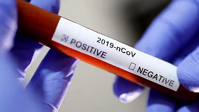 Mevka, Kovid-19 ile mücadelede ve üretimde destek vermeye devam edecek