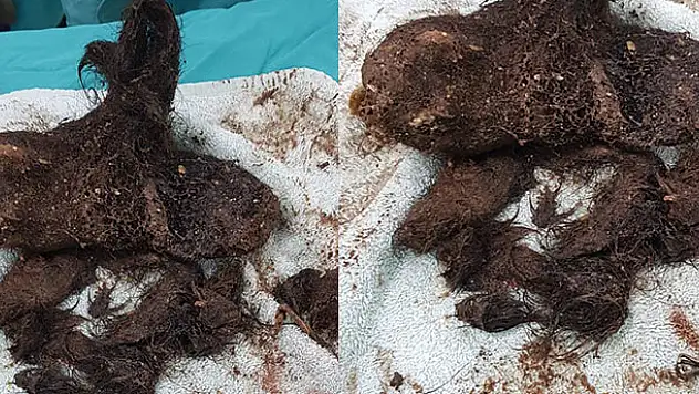 Midesinden çıkanlar doktorları bile şaşırttı! Tam 700 gram