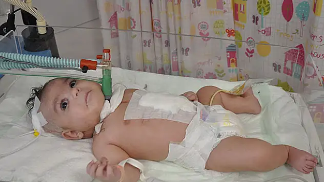 Minik Yılmaz '30 dakikalık' mola sonrası yaşama tutundu