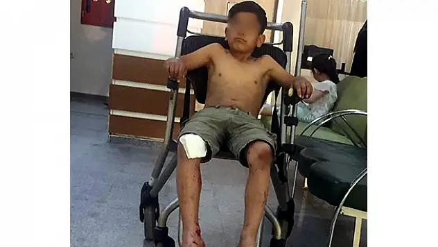 Motosikletten düşen çocuk hastanelik oldu 