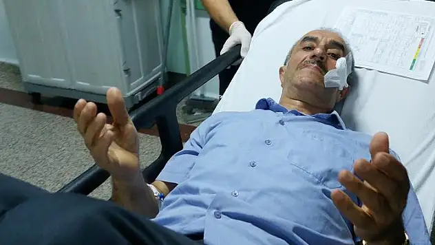 Nişan töreninde maganda kurşunuyla yüzünden vuruldu
