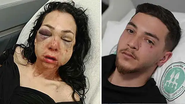 Oğlunun gözü önünde anneyi öldüresiye dövdüler: ''Küfür etmeyin' dedik diye bu hale geldim'