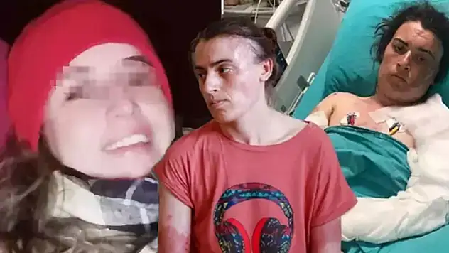 Önce bıçakladı sonra kaynar suyla yaktı! Elti teröründe karar
