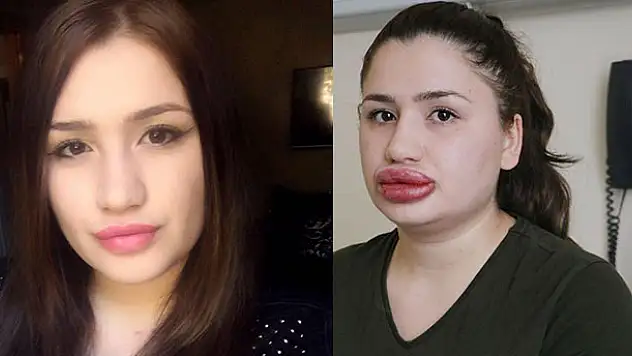 Onu bu hale kendisini estetik uzmanı olarak tanıtan kuaför getirdi!