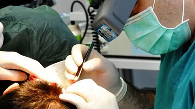 Saç Ektirirken Sağlığınızdan Olmayın