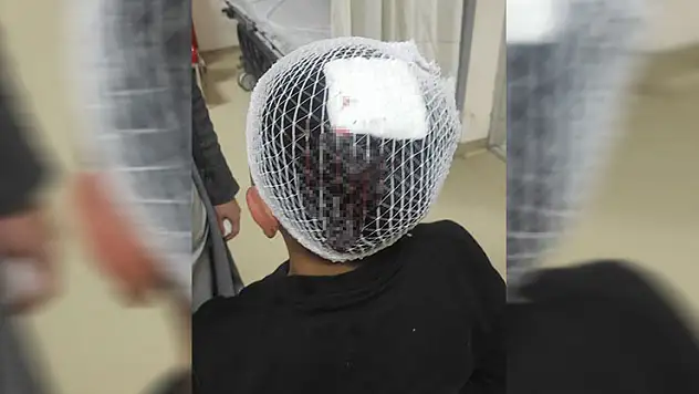 Şampiyonluk kutlamasında havai fişek 9 yaşındaki çocuğun kafasına isabet etti