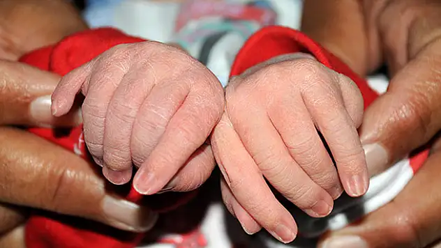 Şanlıurfa'da 24 parmaklı bebek doğdu