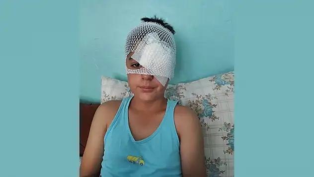 Şanlıurfa'da köpek saldırısından kaçan çocuğa otomobil çarptı