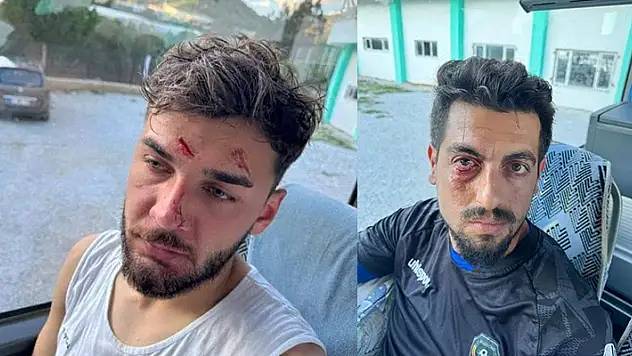 Sarayönü Belediye'ye çirkin saldırı
