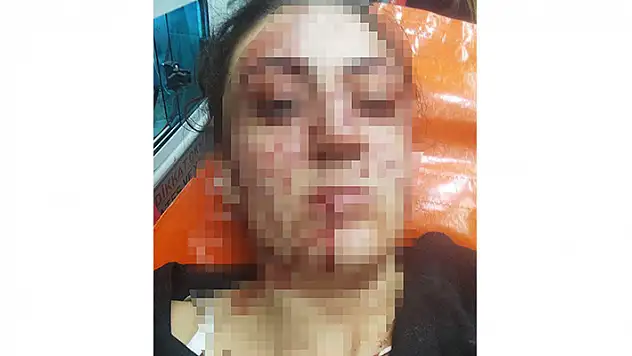 Sinem'i 7 yerinden bıçaklayan eski eşi 9 ayda tahliye edildi
