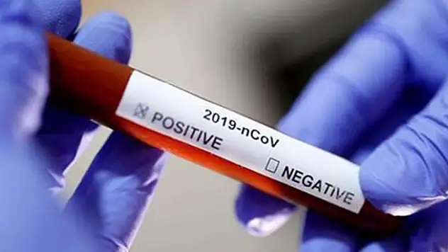 Slovakya'da koronavirüs nedeniyle OHAL kararı