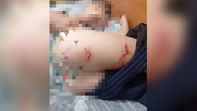 Sokak köpekleri faciaya neden oluyordu: Komşular yetişmeseydi parçalayacaklardı