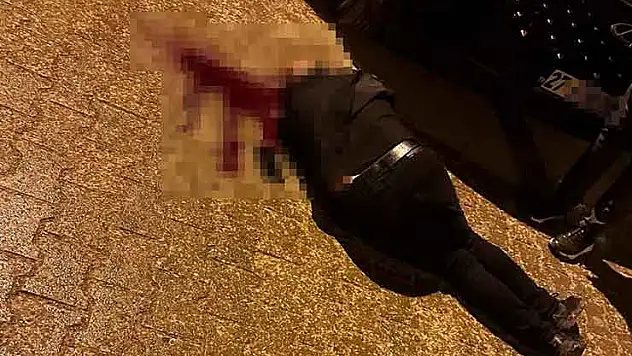 Sokakta yürürken tabanca ile başından vuruldu