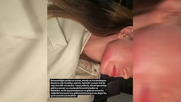 Sosyal medya fenomeni Danla Biliç eski sevgilisi tarafından darp edildi