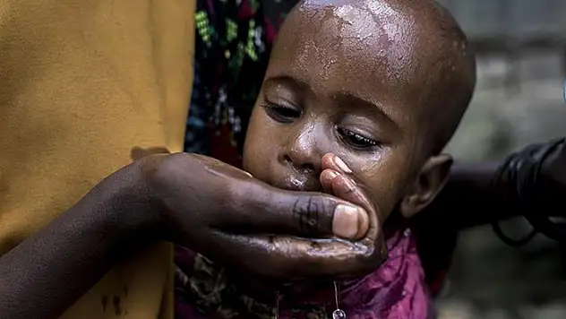 Sudan'daki kolera salgını nedeniyle hayatını kaybedenlerin sayısı 335'e yükseldi
