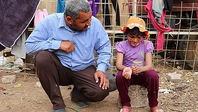 Suriyeli Emira 'estetik' için yardım bekliyor