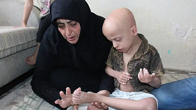 Suriyeli Hasan yardım eli bekliyor