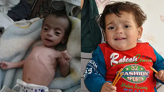 Suriyeli minik Fatıma, dünyada nadir görülen hastalığı yendi